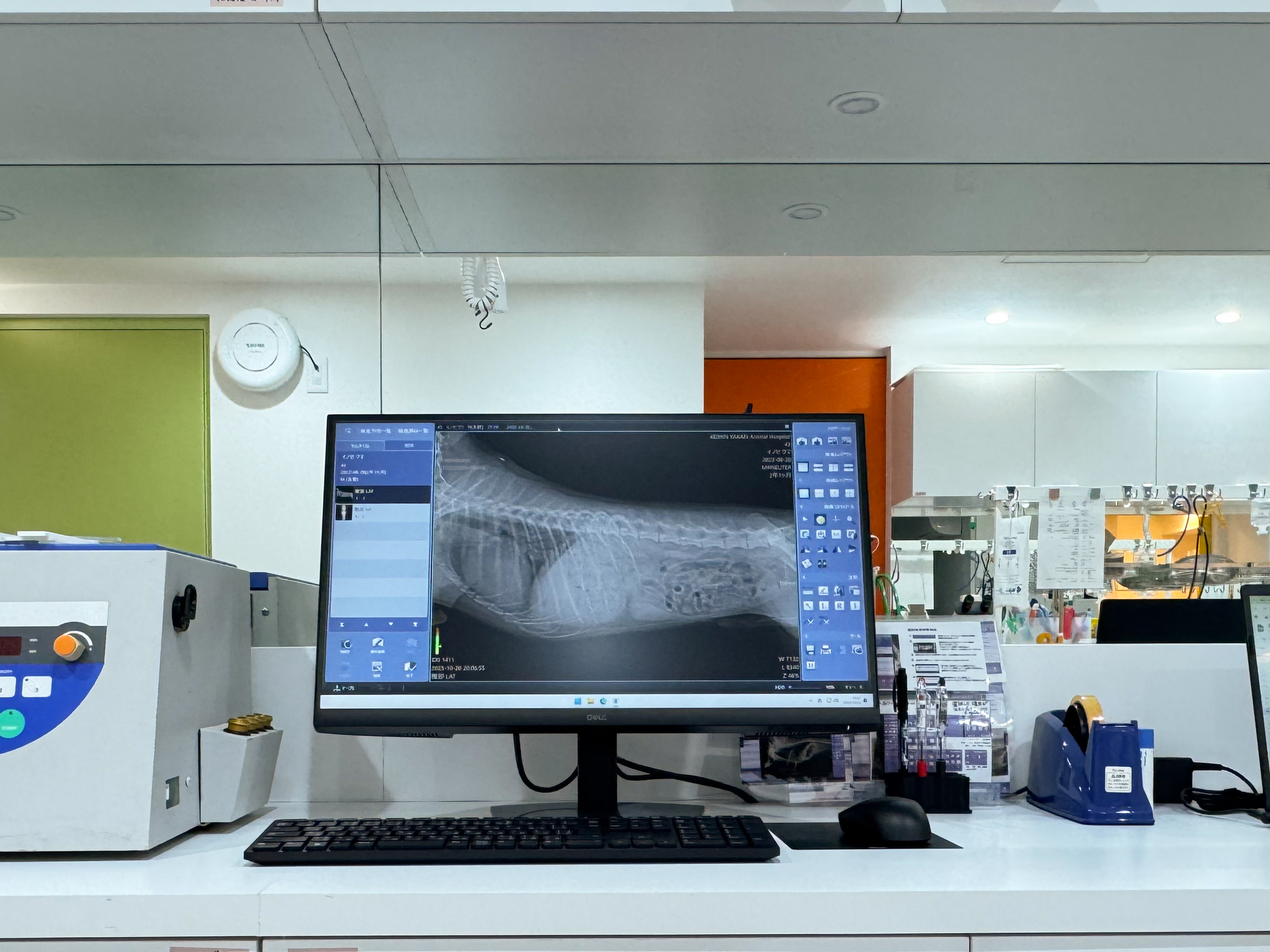 デジタルレントゲン装置- 2枚目