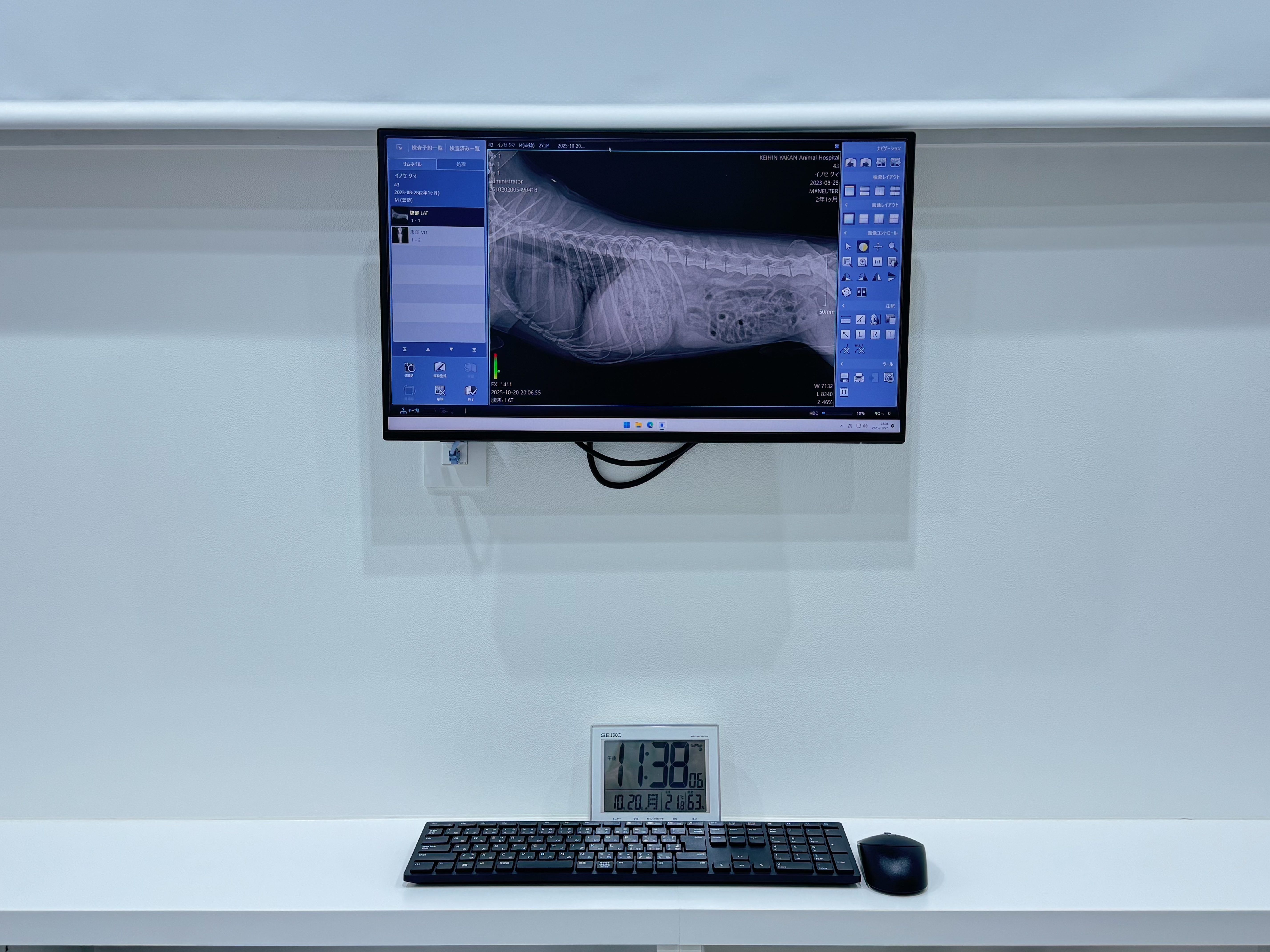 デジタルレントゲン装置- 3枚目